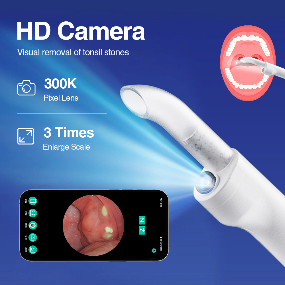 Smart Visual Tonsil Stone Remo - Lighting Visual 评论和价格
